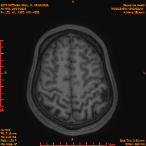 2025-06-14/AX MPR/0153-IM758.png