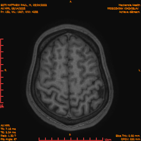 2025-06-14/AX MPR/0154-IM759.png