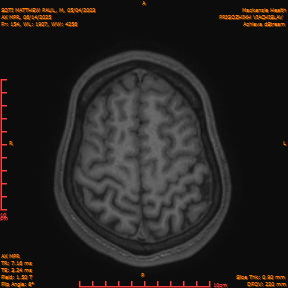 2025-06-14/AX MPR/0155-IM760.png