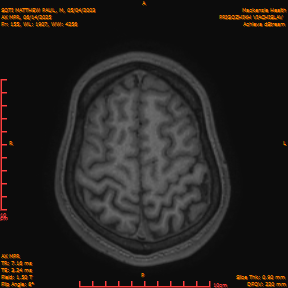 2025-06-14/AX MPR/0156-IM761.png