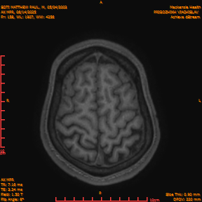 2025-06-14/AX MPR/0159-IM764.png