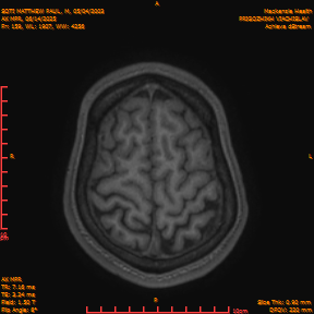 2025-06-14/AX MPR/0160-IM765.png