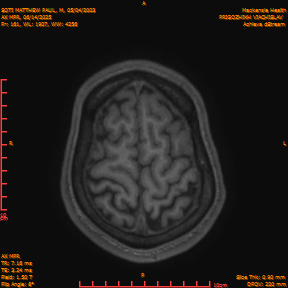 2025-06-14/AX MPR/0162-IM767.png