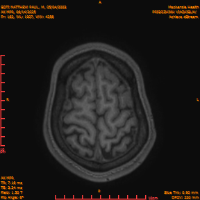 2025-06-14/AX MPR/0163-IM768.png