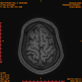 2025-06-14/AX MPR/0164-IM769.png