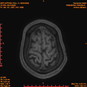 2025-06-14/AX MPR/0165-IM770.png