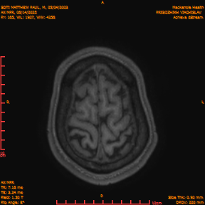 2025-06-14/AX MPR/0166-IM771.png