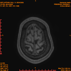 2025-06-14/AX MPR/0168-IM773.png