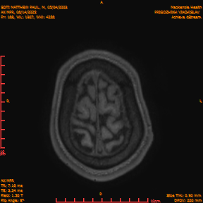 2025-06-14/AX MPR/0169-IM774.png