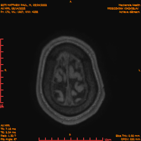2025-06-14/AX MPR/0171-IM776.png
