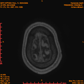 2025-06-14/AX MPR/0172-IM777.png