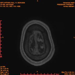 2025-06-14/AX MPR/0173-IM779.png