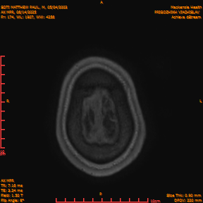 2025-06-14/AX MPR/0175-IM780.png