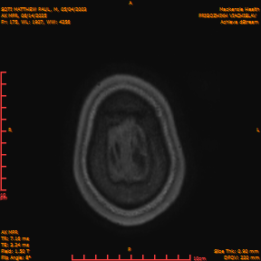 2025-06-14/AX MPR/0176-IM781.png