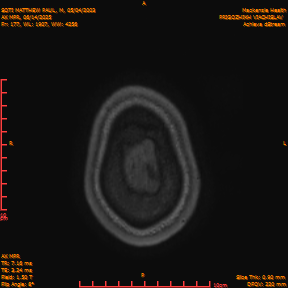 2025-06-14/AX MPR/0178-IM783.png