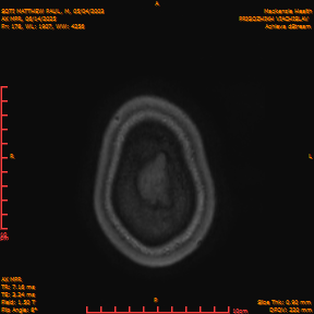 2025-06-14/AX MPR/0179-IM784.png
