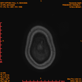 2025-06-14/AX MPR/0180-IM785.png