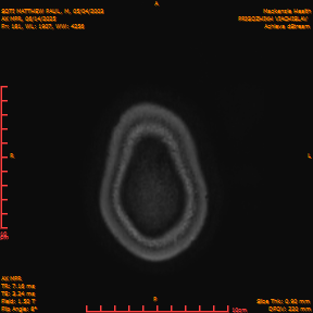 2025-06-14/AX MPR/0182-IM786.png