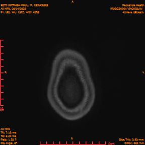 2025-06-14/AX MPR/0183-IM788.png
