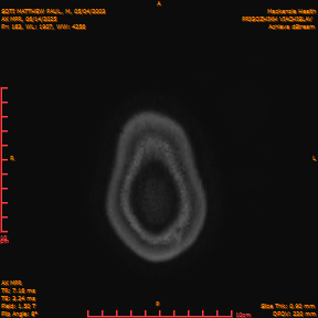2025-06-14/AX MPR/0184-IM789.png