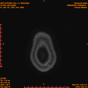 2025-06-14/AX MPR/0185-IM790.png