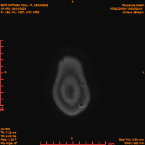 2025-06-14/AX MPR/0187-IM792.png