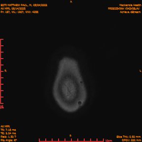 2025-06-14/AX MPR/0188-IM793.png