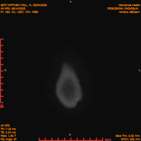 2025-06-14/AX MPR/0190-IM795.png