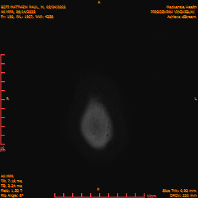2025-06-14/AX MPR/0191-IM796.png