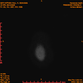 2025-06-14/AX MPR/0192-IM797.png