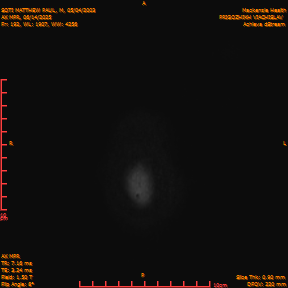 2025-06-14/AX MPR/0193-IM798.png