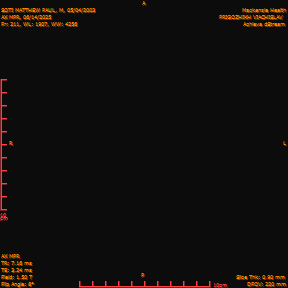 2025-06-14/AX MPR/0212-IM817.png