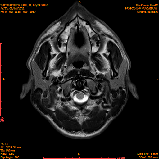 2025-06-14/AX T2/0001-IM836.png