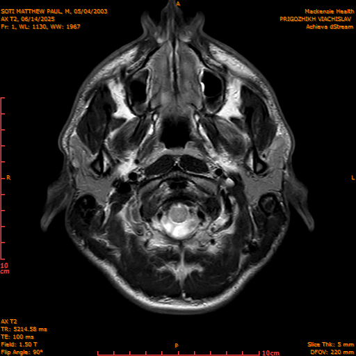 2025-06-14/AX T2/0002-IM837.png