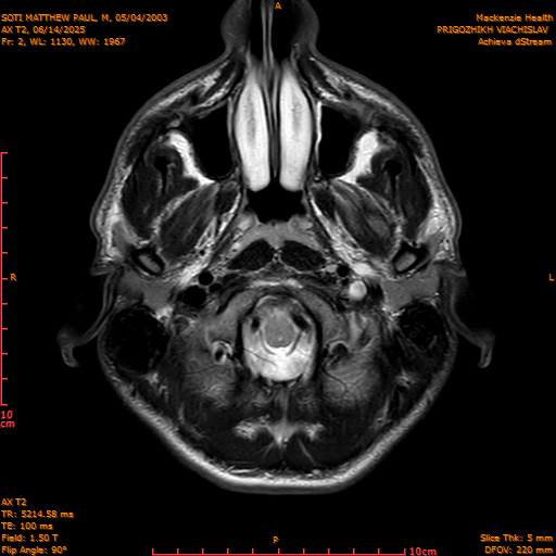 2025-06-14/AX T2/0003-IM838.png