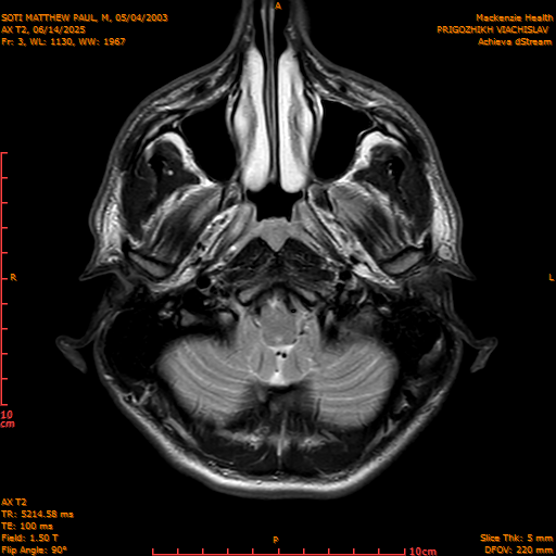 2025-06-14/AX T2/0004-IM839.png