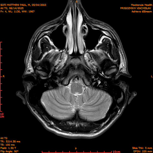 2025-06-14/AX T2/0005-IM840.png