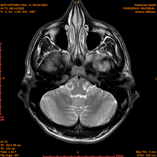 2025-06-14/AX T2/0006-IM841.png