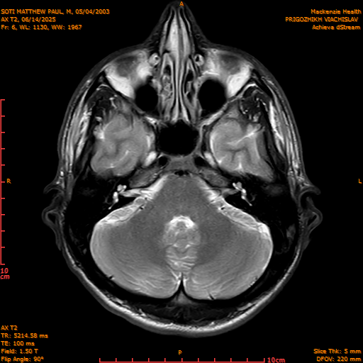 2025-06-14/AX T2/0007-IM842.png