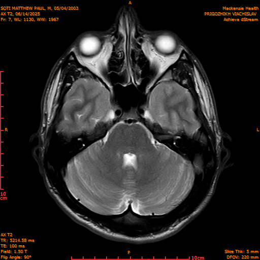 2025-06-14/AX T2/0008-IM843.png