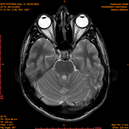 2025-06-14/AX T2/0009-IM844.png