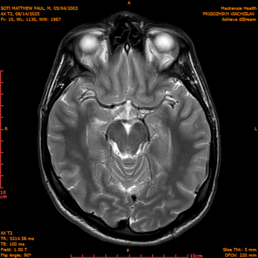 2025-06-14/AX T2/0011-IM846.png