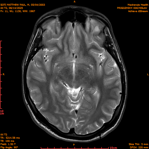 2025-06-14/AX T2/0012-IM847.png