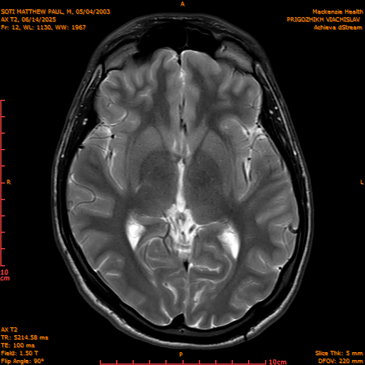 2025-06-14/AX T2/0013-IM848.png