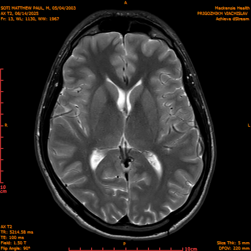 2025-06-14/AX T2/0014-IM849.png