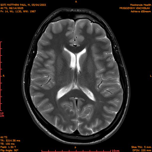 2025-06-14/AX T2/0015-IM850.png