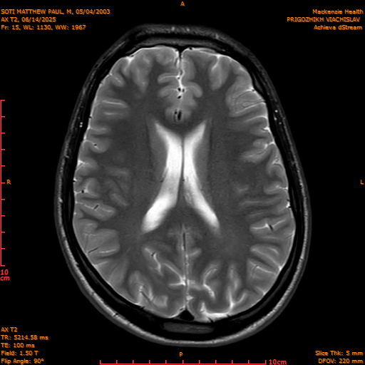 2025-06-14/AX T2/0016-IM851.png