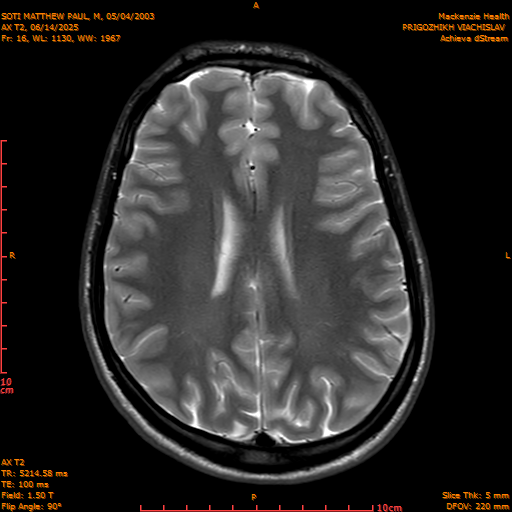 2025-06-14/AX T2/0017-IM852.png