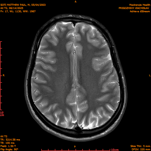 2025-06-14/AX T2/0018-IM853.png