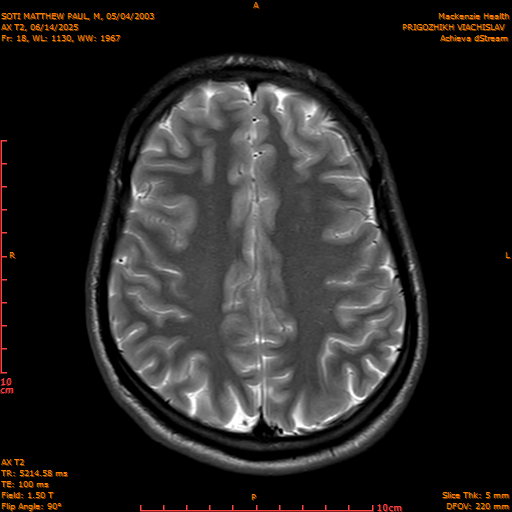 2025-06-14/AX T2/0019-IM854.png